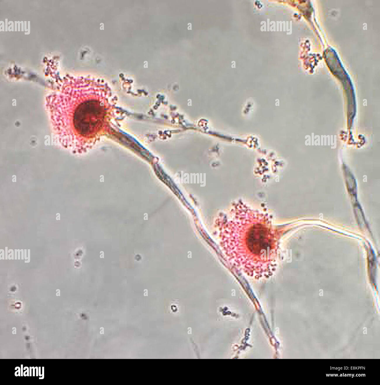 Diese Mikrophotographie zeigt einige der Ultrastrukturforschung Morphologie von pilzlichen Organismus Aspergillus Fumigatus der angezeigten Stockfoto