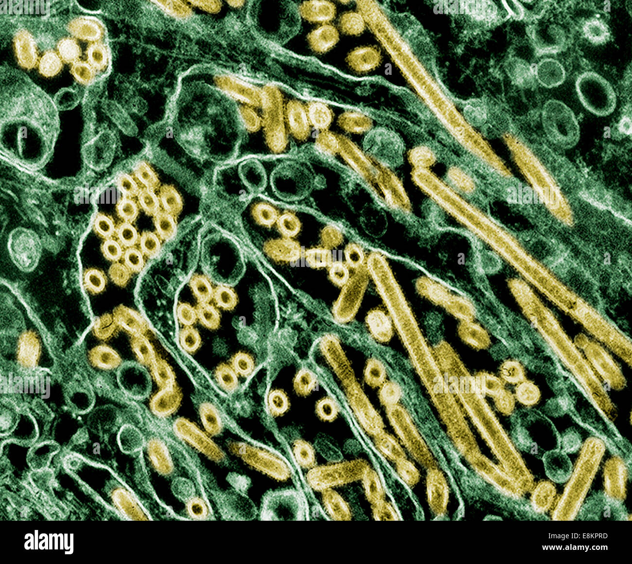 Eingefärbte Transmission Electron Schliffbild der Aviären Influenza H5N1 Viren gewachsen in MDCK-Zellen-aviäre Influenza-Viren nicht Stockfoto