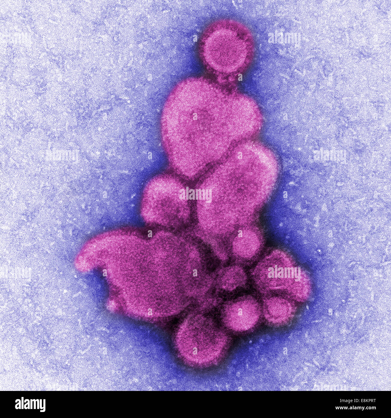 Dieser eingefärbte negativ gefärbten Transmission Electron Schliffbild (TEM) erfasst einige Ultrastrukturforschung Details ausgestellt durch Stockfoto