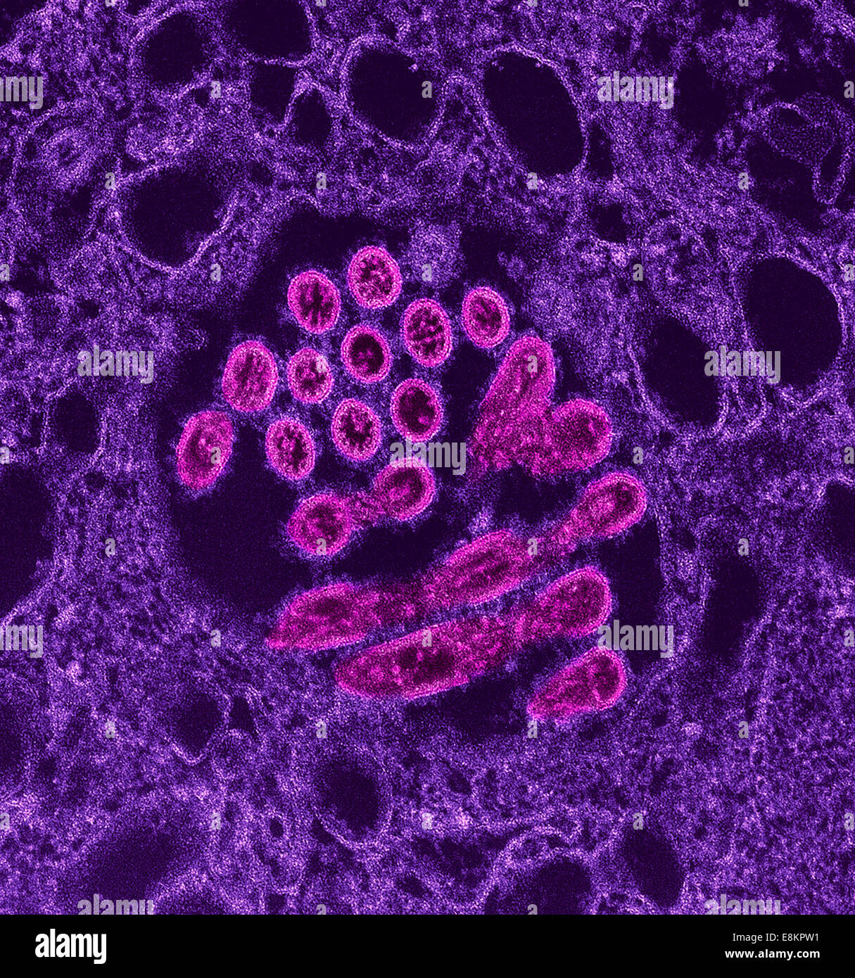Dieser eingefärbte Transmission Electron Schliffbild (TEM) zeigte Präsenz vieler Roman H1N1 Virus Virionen in diesem Gewebe Stockfoto