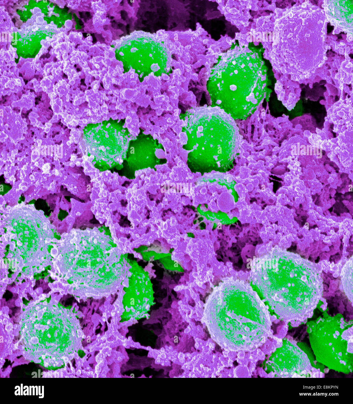 Scan Electromicrograph von Staphylococcus AureusBakterien