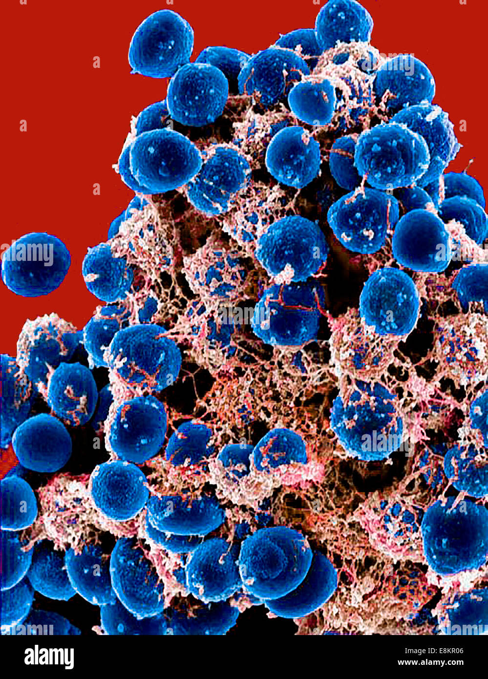 Scanning Electron Schliffbild Büschel von Staphylococcus Epidermidis Bakterien im extrazellulären Matrix, die Zellen verbindet und Stockfoto
