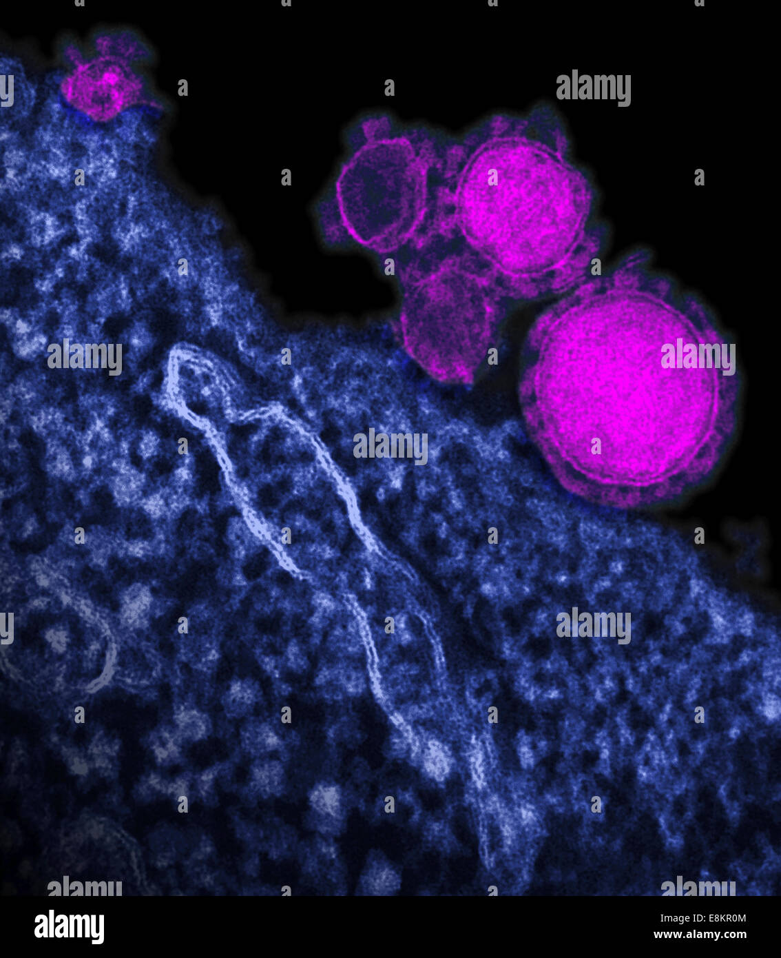 Eingefärbte Übertragung Elektronen Schliffbild des Nahen Osten respiratorisches Syndrom Coronavirus Partikel. Stockfoto