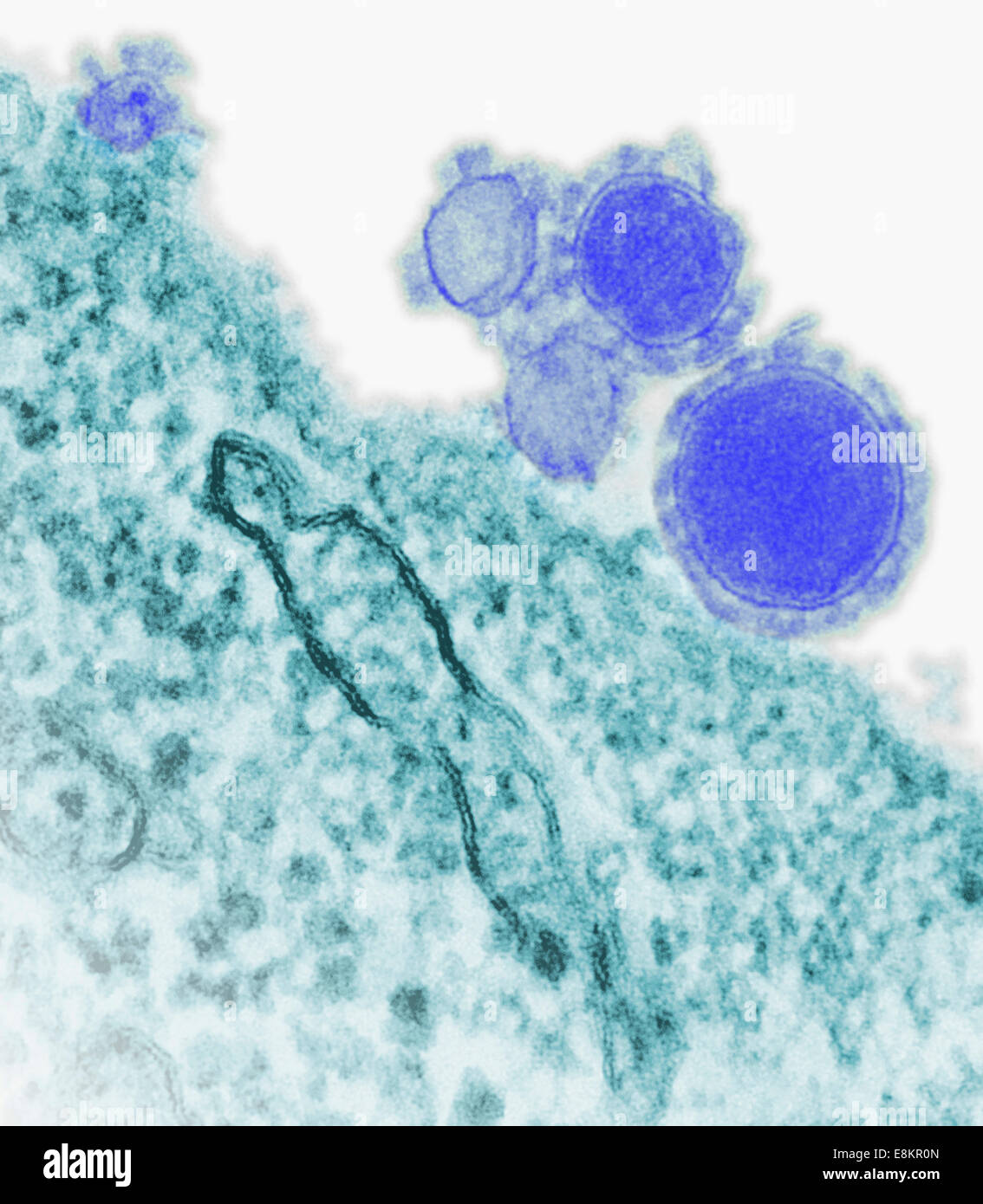 Eingefärbte Übertragung Elektronen Schliffbild des Nahen Osten respiratorisches Syndrom Coronavirus Partikel. Stockfoto