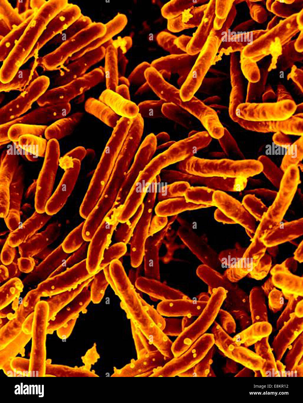 Scanning Electron Schliffbild der Mycobacterium-Tuberkulose-Bakterien, die TB verursachen. Stockfoto