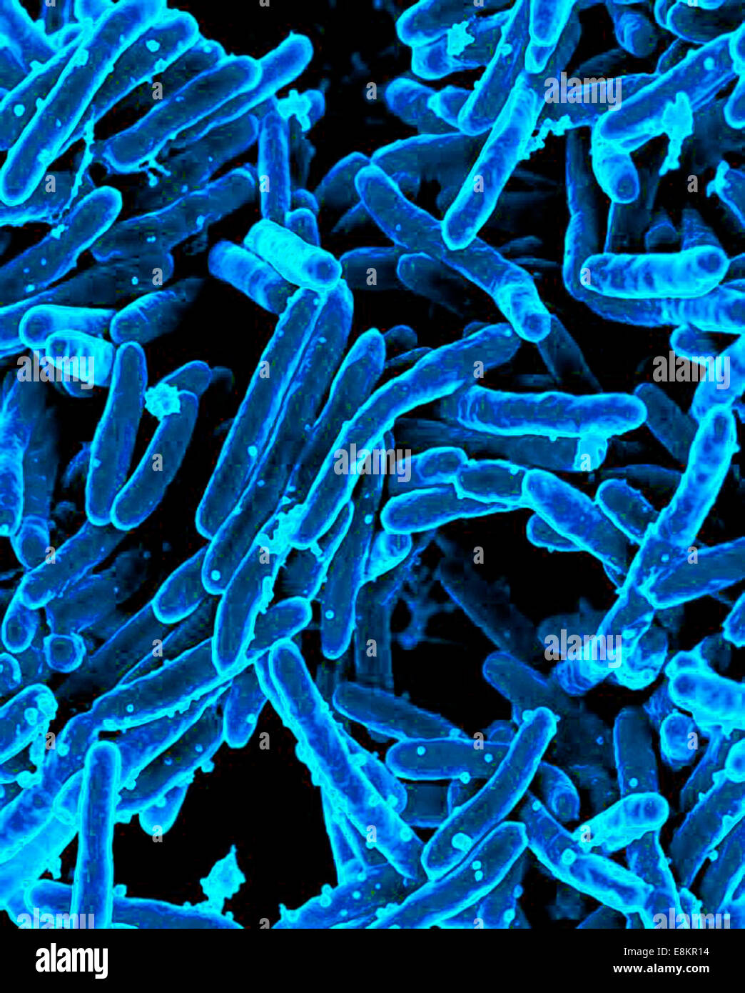 Scanning Electron Schliffbild der Mycobacterium-Tuberkulose-Bakterien, die TB verursachen. Stockfoto