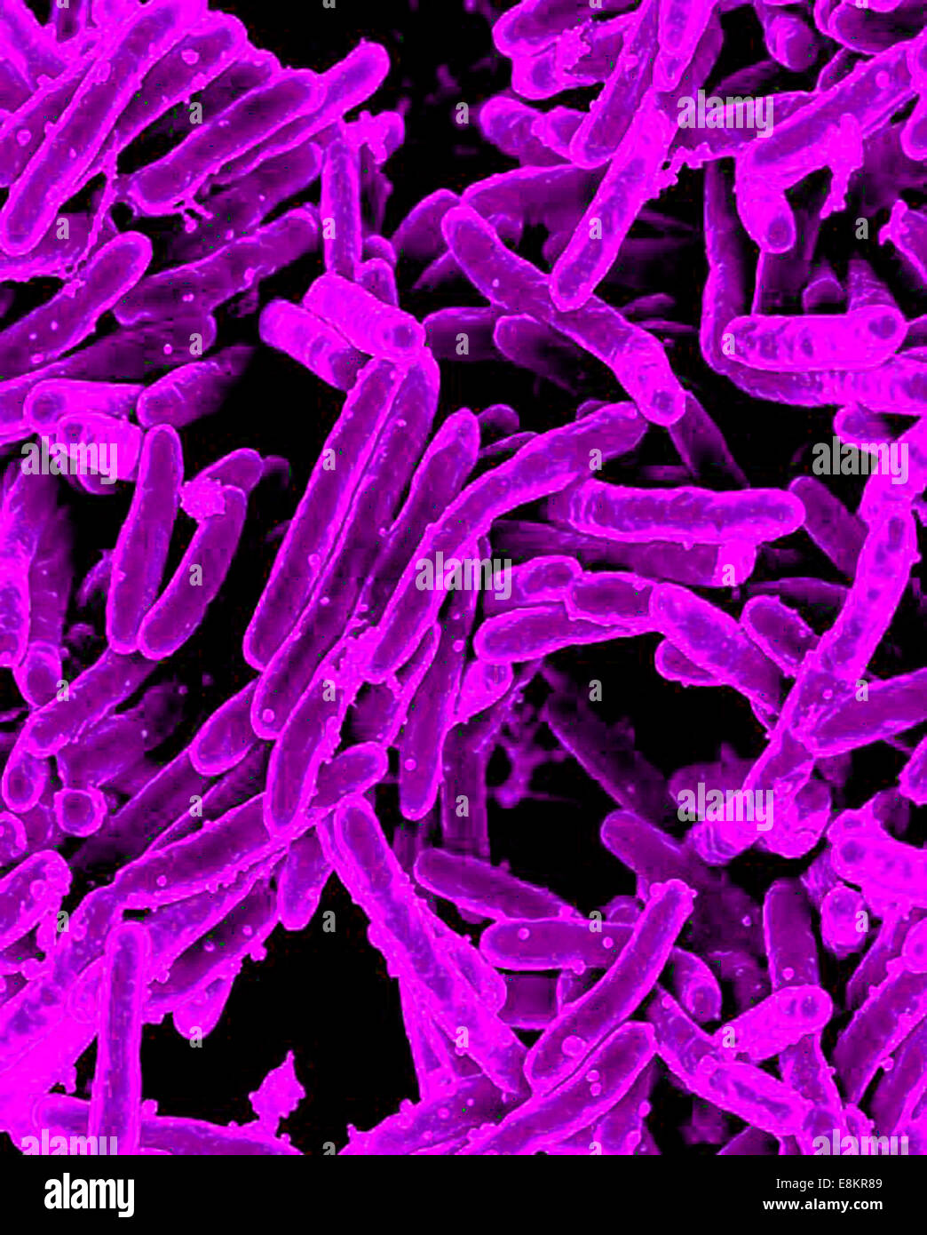 Scanning Electron Schliffbild der Mycobacterium-Tuberkulose-Bakterien, die TB verursachen. Stockfoto