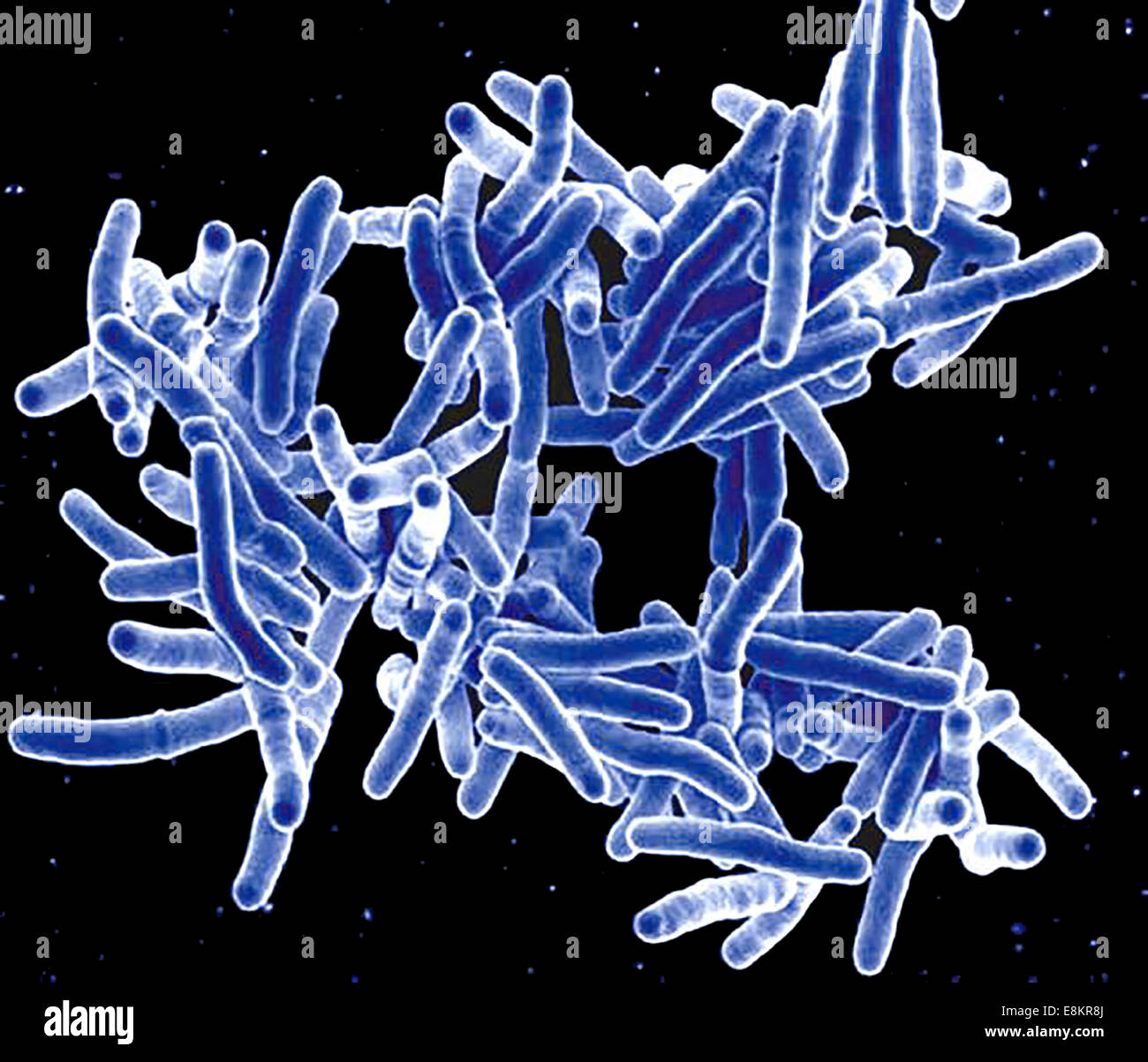 Scanning Electron Schliffbild der Mycobacterium-Tuberkulose-Bakterien, die TB verursachen. Stockfoto