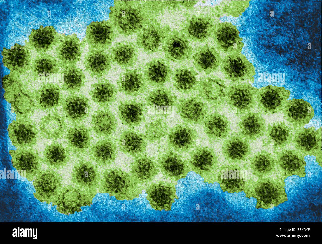 Diese Übertragung Elektronen Schliffbild (TEM) zeigte einige der Ultrastrukturforschung Morphologie von Norovirus Virionen angezeigt oder Stockfoto