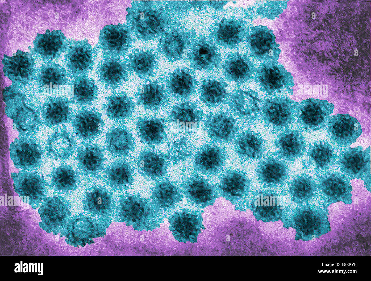 Diese Übertragung Elektronen Schliffbild (TEM) zeigte einige der Ultrastrukturforschung Morphologie von Norovirus Virionen angezeigt oder Stockfoto