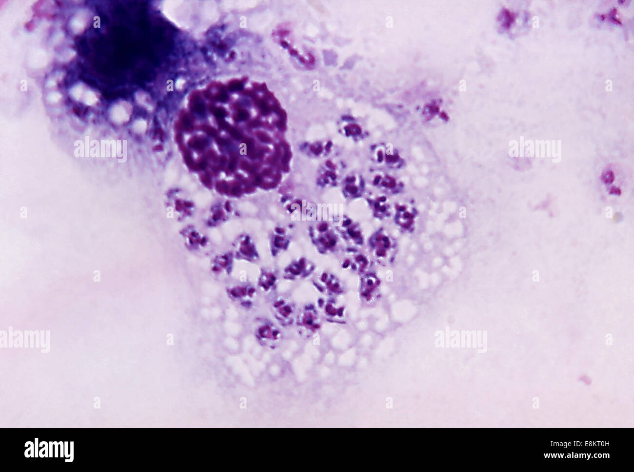 Diese Giemsa gefärbten Schliffbild zeigt während ihrer Leishmanial-Stadium der Entwicklung T Trypanosoma Trypanosomen Trypanosoma einzelliger Parasit, Stockfoto