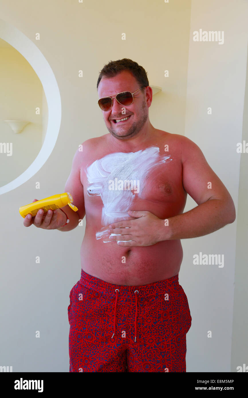 Sehr Sonne verbrannt Mann auftragen Creme Stockfoto