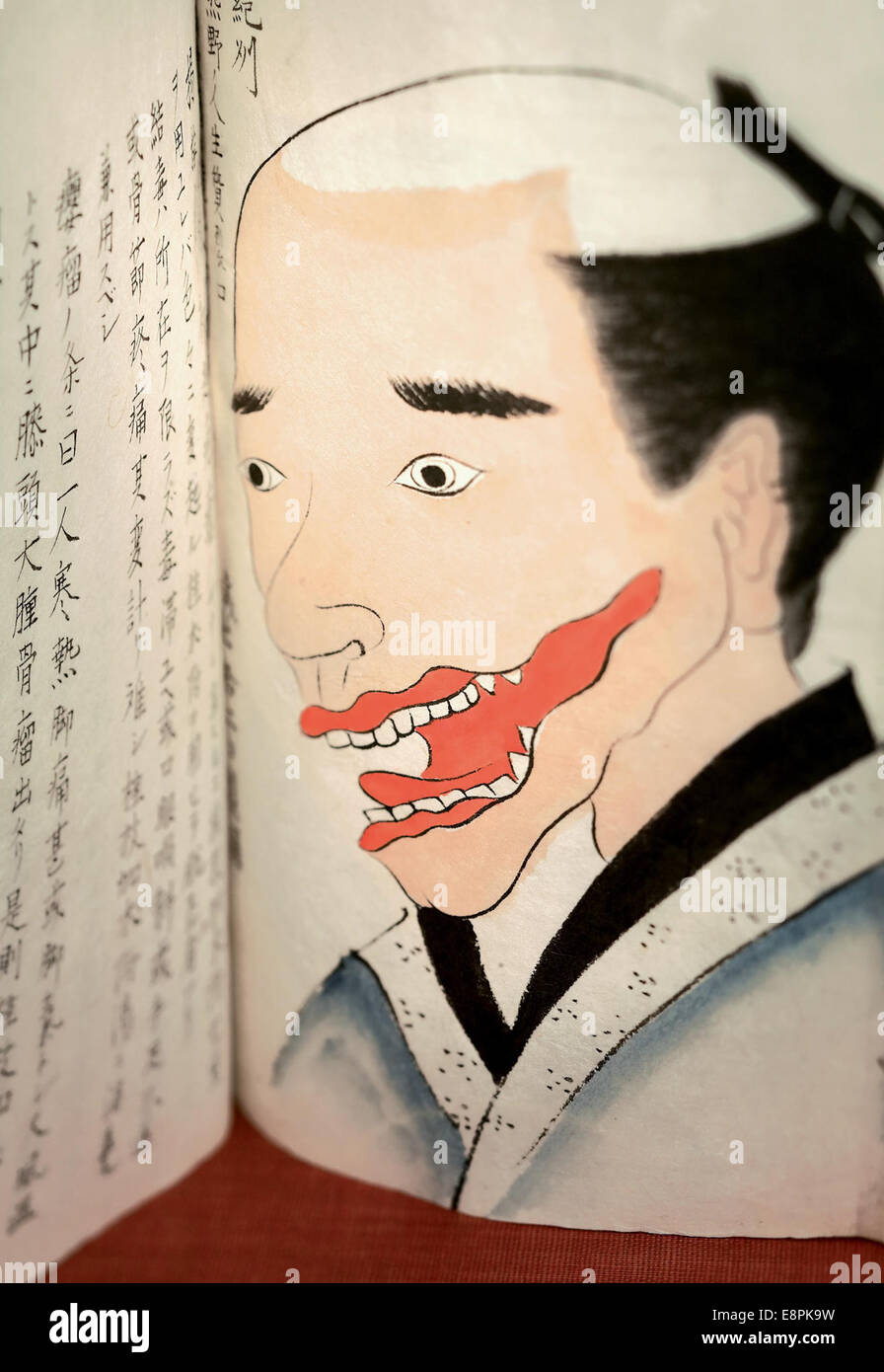 Erscheint In: Hanaoka, Seishū, 1760-1835. Bunsen Kiroku.   Bildbeschreibung: Bild einer offenen illustrierte Manuskript zeigen die Stockfoto