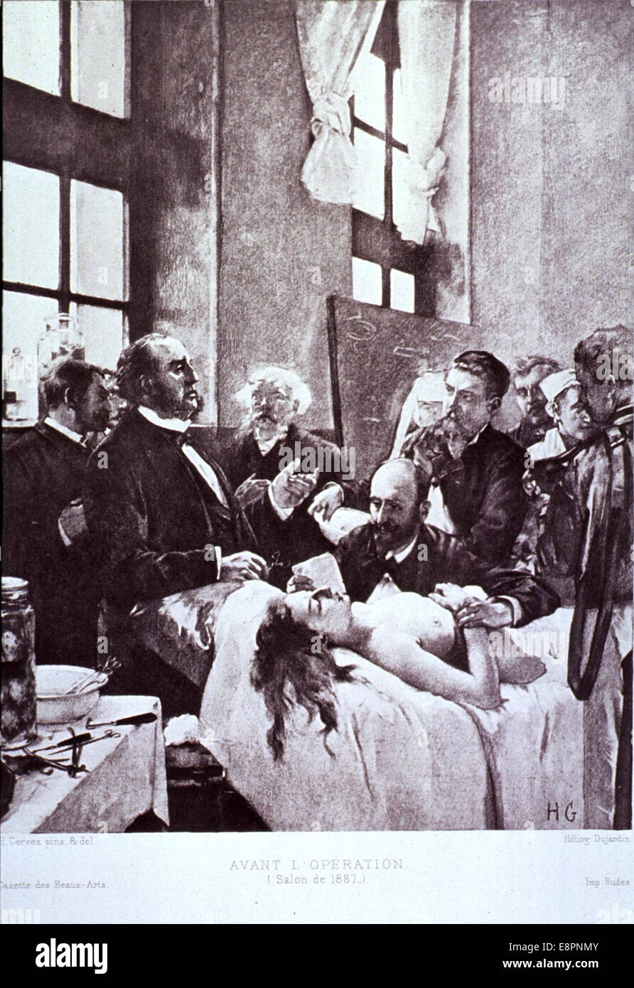 Avant l'Opération Salon de 1887 Stockfoto
