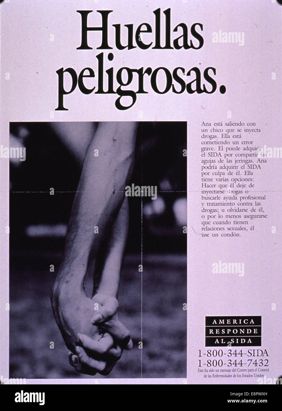 Dieses von den Centers for Disease Control (CDC) produzierte schwarz-weiße AIDS-Awareness-Poster hebt die Gefahren des intravenösen Drogenkonsums als Risikofaktor für AIDS hervor. Das Bild zeigt die Unterarme eines Paares, wobei einer sichtbare „Spuren“ von Drogeninjektionen zeigt, die den Zusammenhang zwischen Drogenmissbrauch und der Ausbreitung von AIDS betonen. Stockfoto
