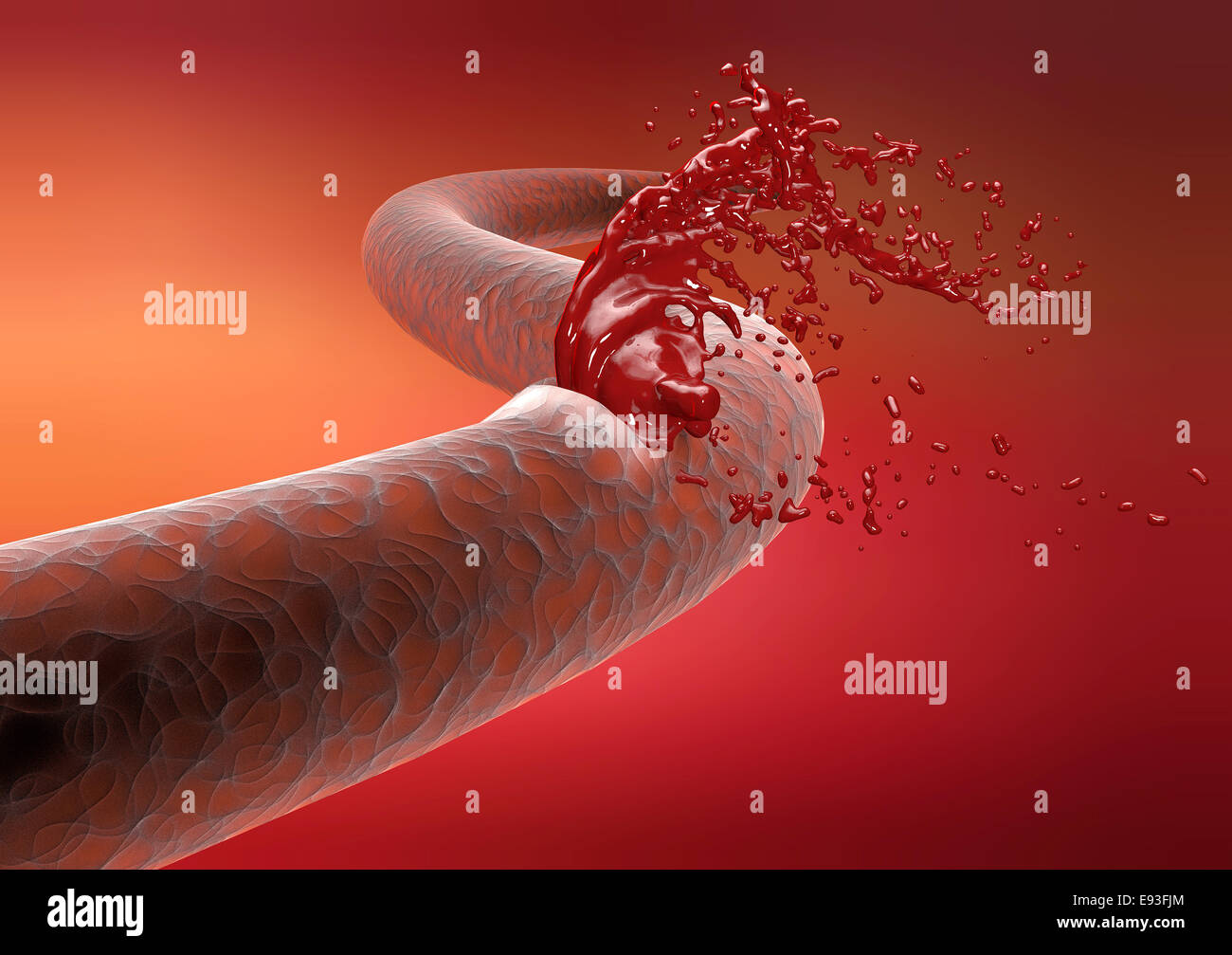 Vene Arterie Bruch Blutungen Blut schneiden Stockfoto