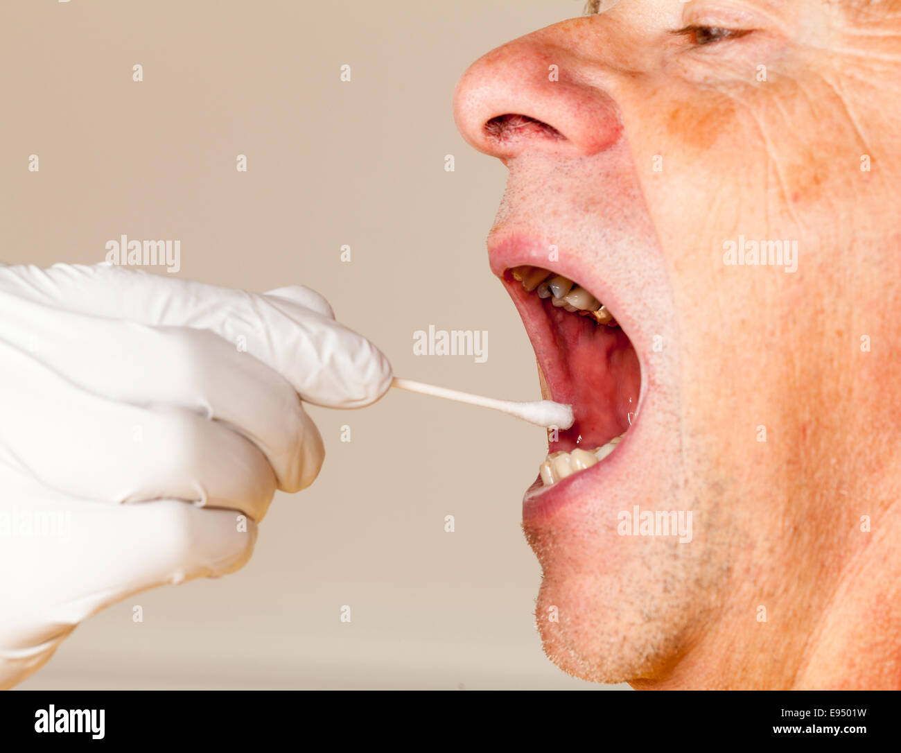 DNA-Abstrich von Speichel entnommen senior woman Stockfoto