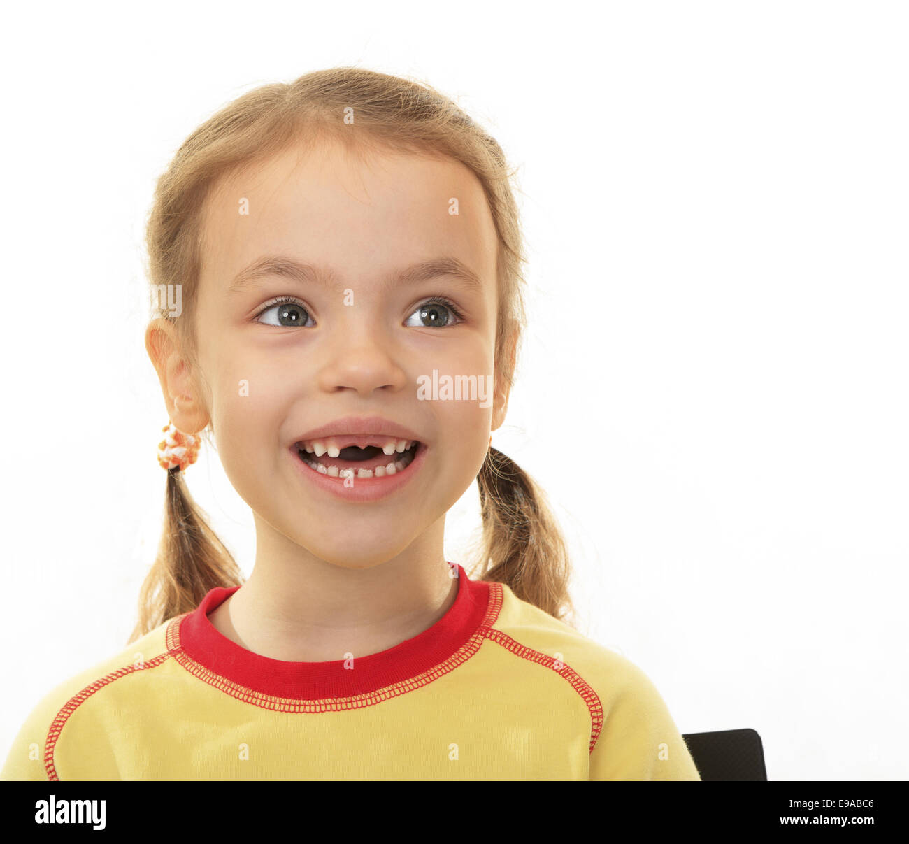 Kleines Mädchen ohne oberen Zähne. Stockfoto