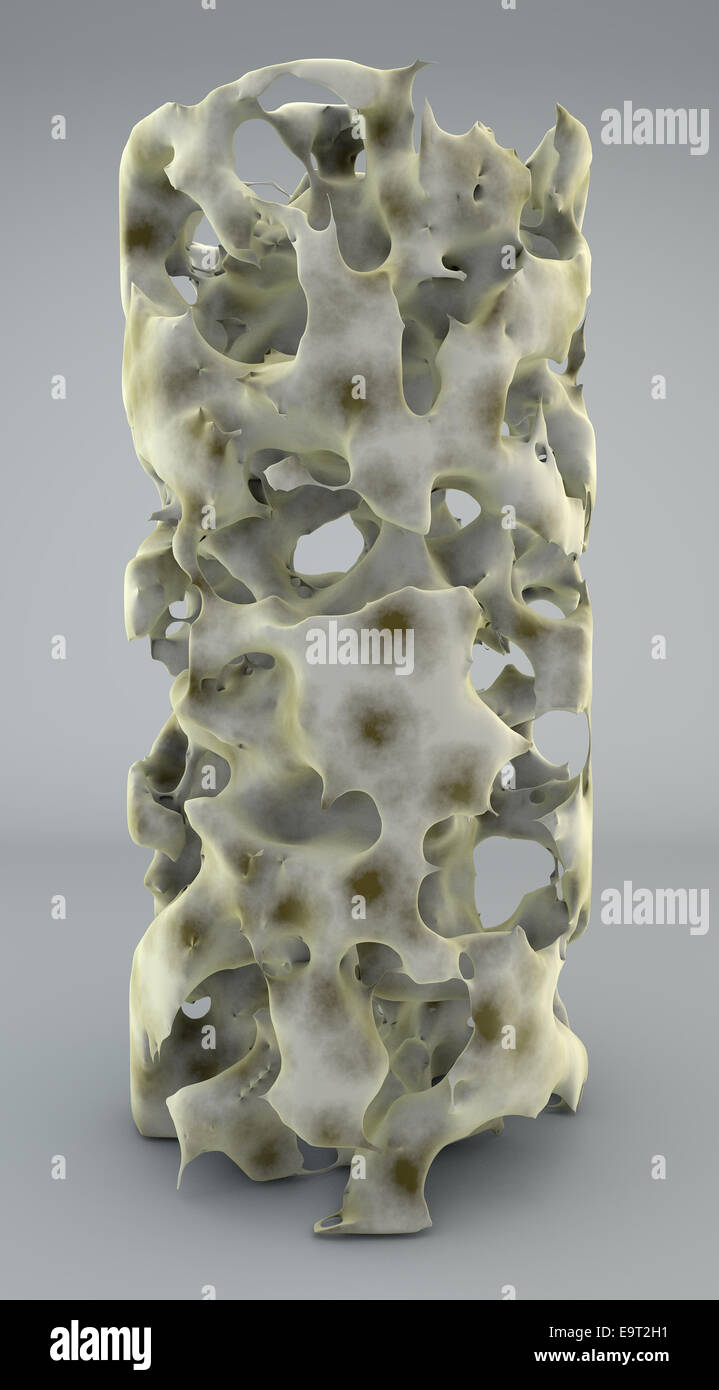 3D Abschnitt des Knochens mit Osteoporose, Anatomie Knochen Stockfoto