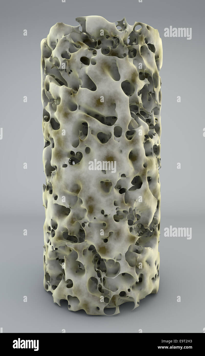 3D Abschnitt des Knochens mit Osteoporose, Anatomie Knochen Stockfoto