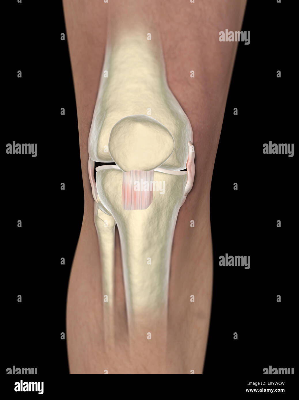 Kniebänder auf Röntgenbildern zu sehen Stockfoto Kniebänder auf Röntgenbildern zu sehen Stockfoto