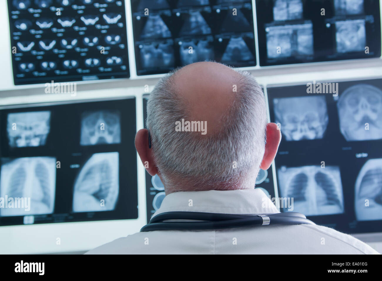 Arzt Analyse Scan-Ergebnisse Stockfoto