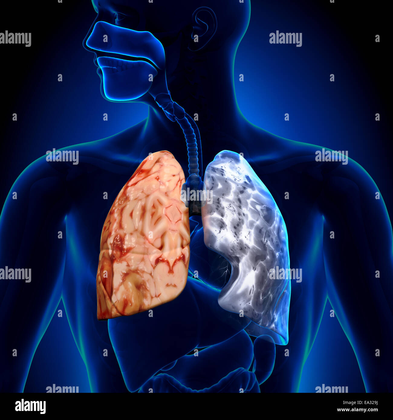 Raucher gegen Nichtraucher - Lunge Anatomie Stockfoto