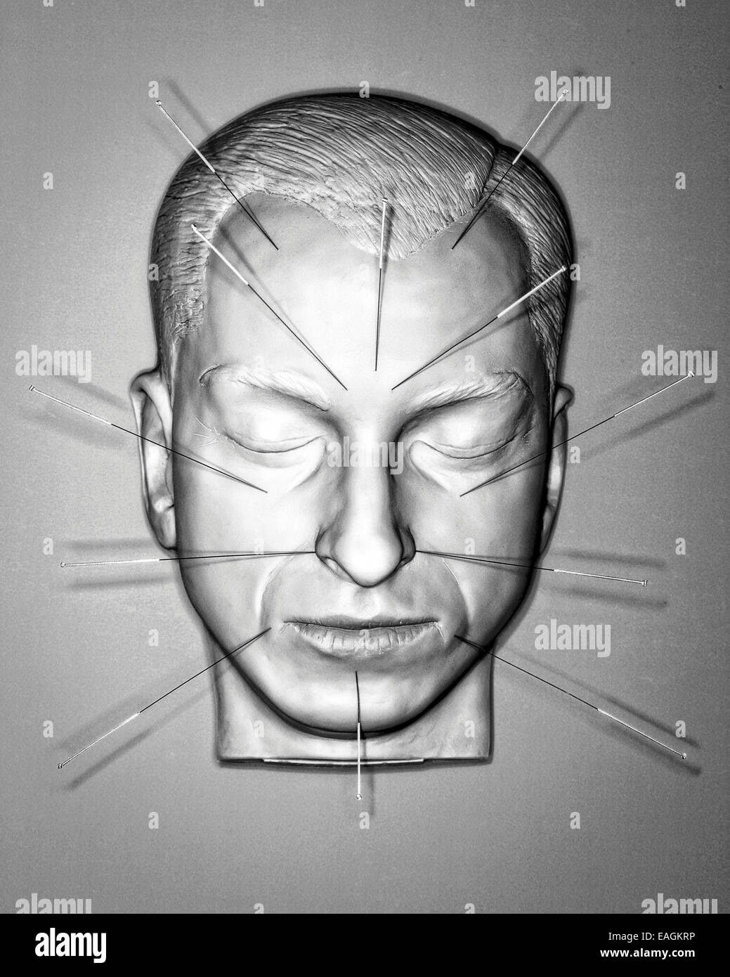 Gesicht-Akupunktur auf männliche Gestalt Stockfoto