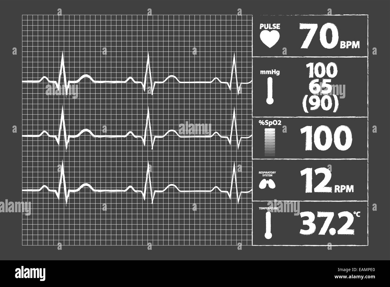 Moderne EKG-Monitor an Tafel Stockfoto