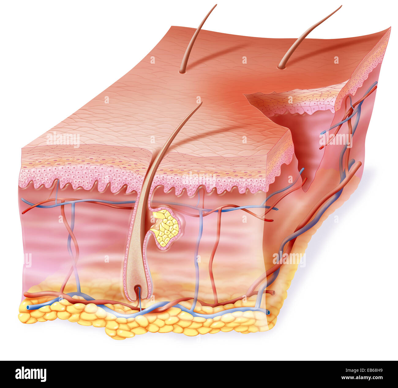 WUNDE, ILLUSTRATION Stockfoto