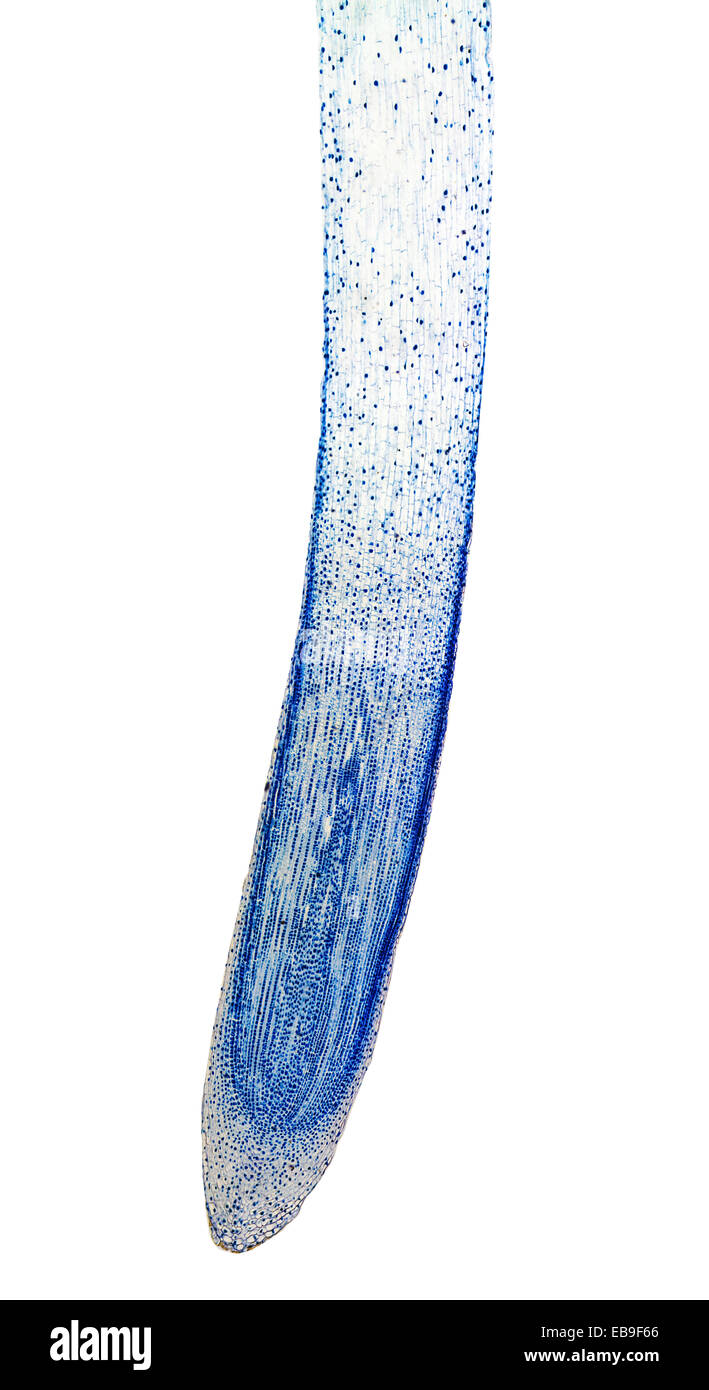Leichte Mikrophotographie der Mitose der Zwiebel Tipp Wurzelzellen durch Mikroskop gesehen Stockfoto