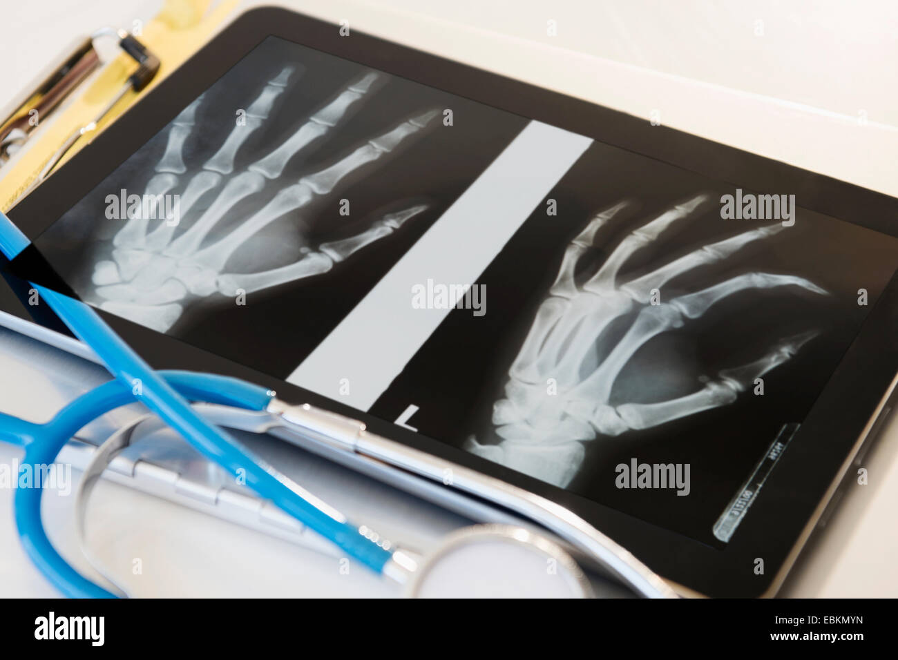 Röntgen der menschlichen Hand auf digital-Tablette Stockfoto