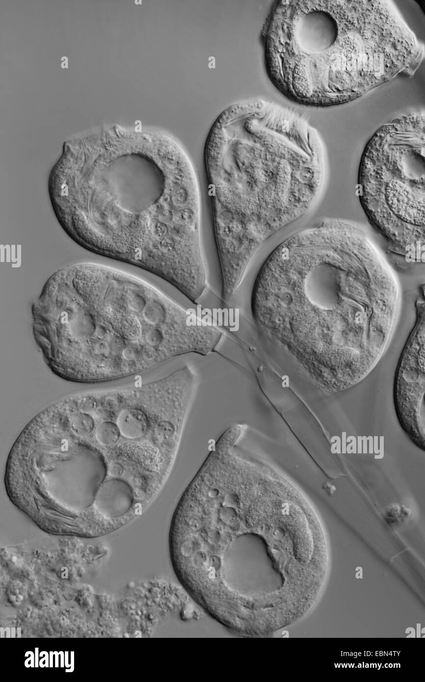 Vorticella (Vorticella spec.), differential Interferenz-Kontrast Stockfoto