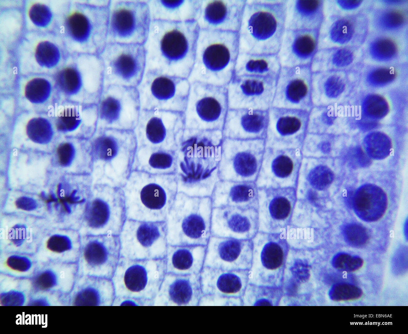 Garten-Zwiebel, Birne Zwiebel, gemeinsame Zwiebel (Allium Cepa), Mitose in Celles der Wurzelspitze einer Zwiebel, 1000 X Stockfoto