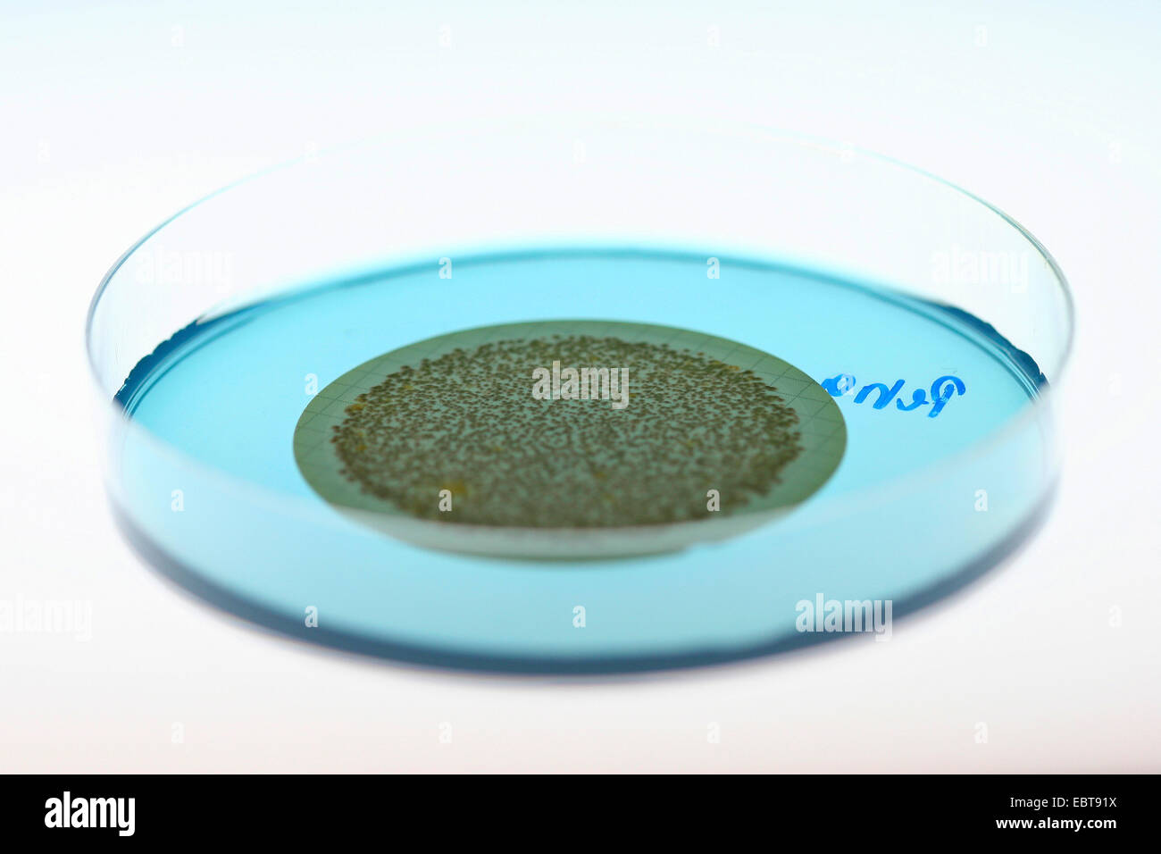Petrischale mit Bakterienkultur Stockfoto