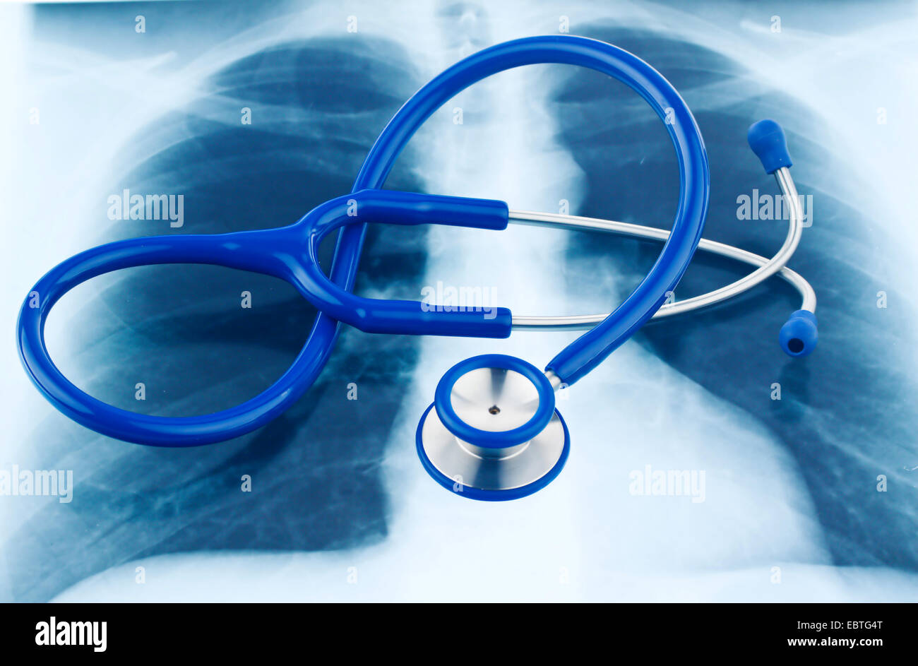 Stethoskop und ein x-ray Stockfoto