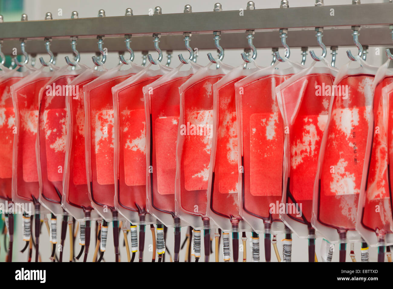 Blut von Blutspendern in der Blut-Labor Stockfoto