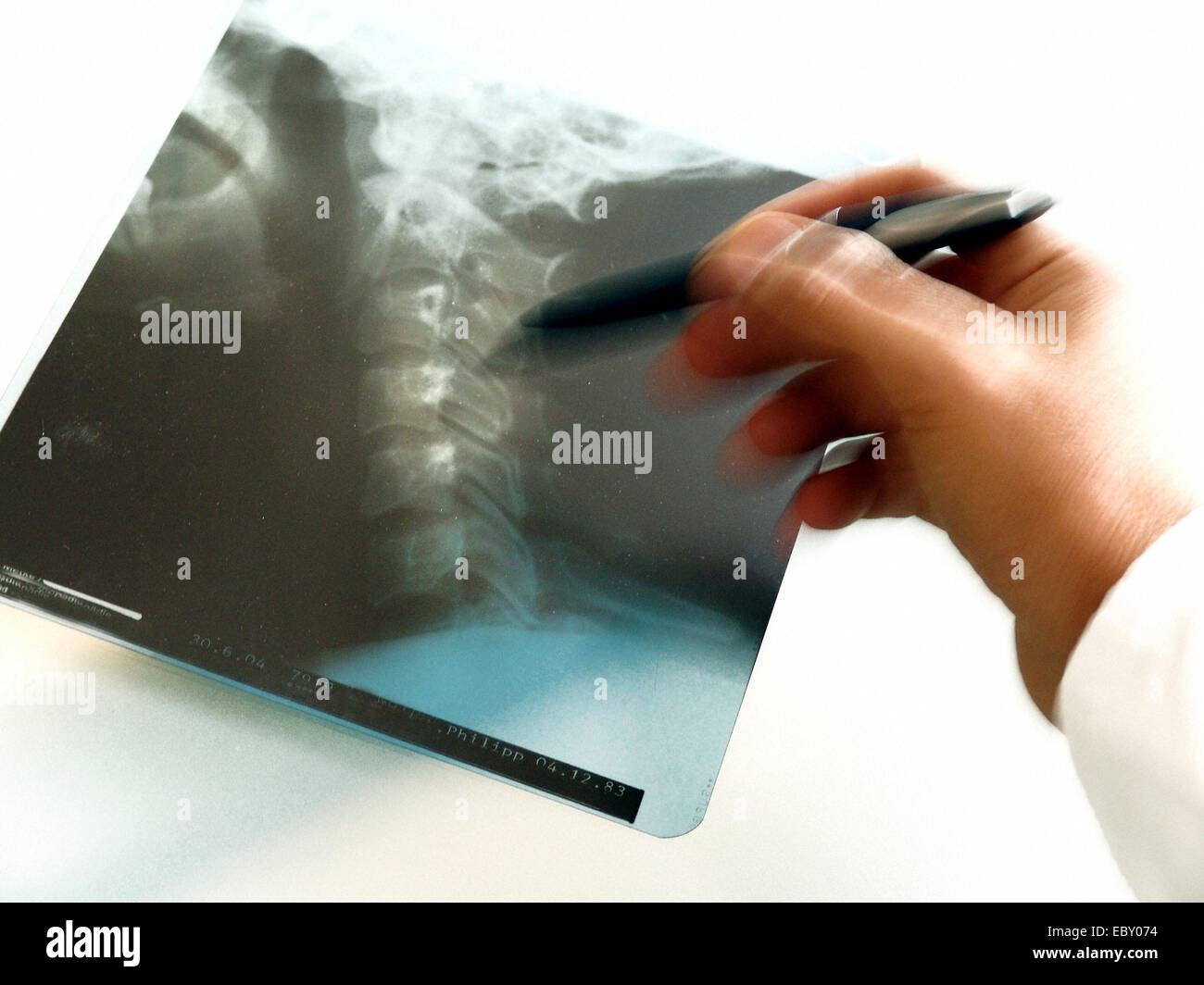 Hand eines Arztes mit Röntgenbild Hals Split CD Stockfoto