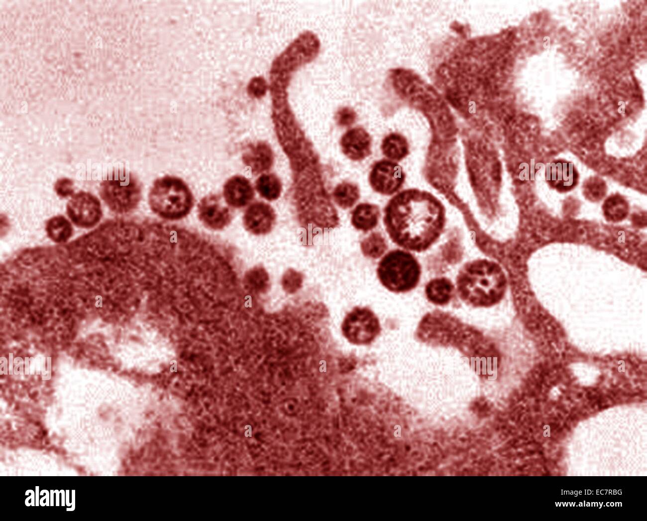Stark vergrößerte Zellen zeigen das Lassa-virus Stockfoto