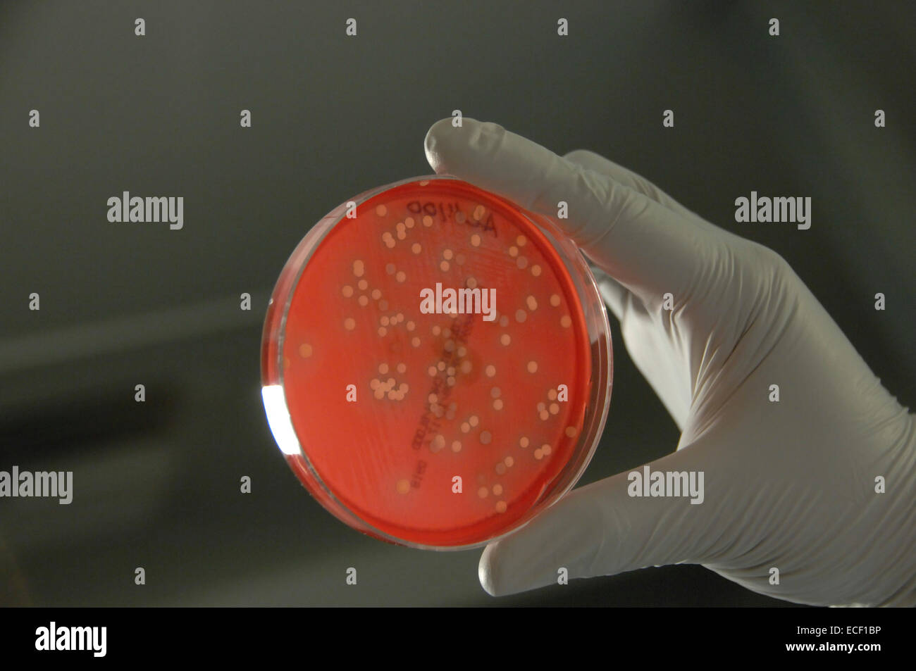 Bakterien aus der menschlichen Haut auf Agar im Labor gezüchtet. Stockfoto