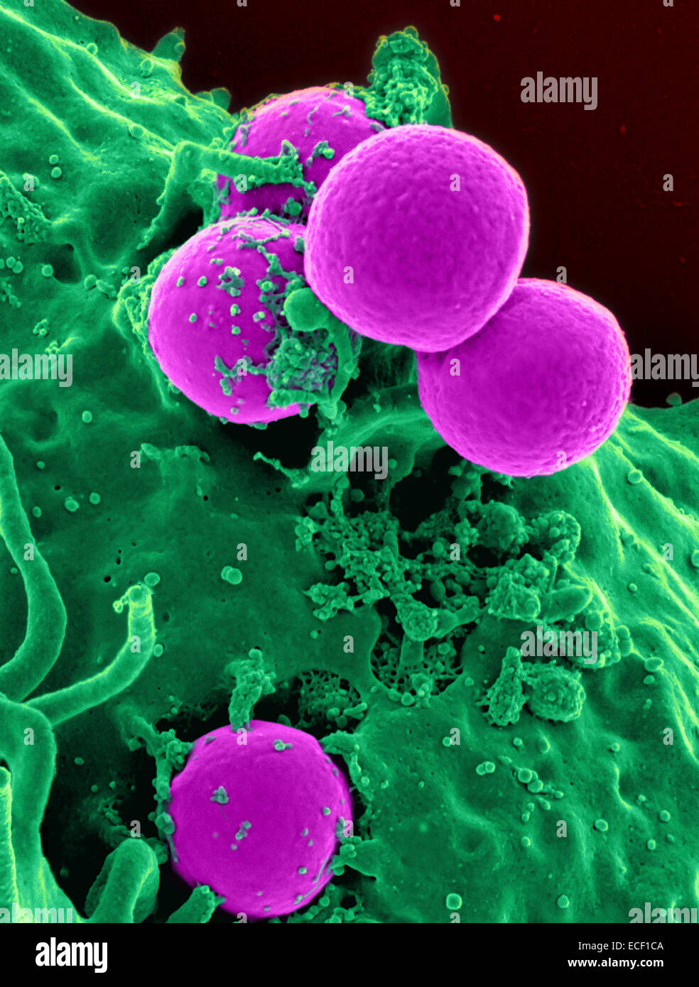 Scanning Electron Schliffbild einer menschlichen Neutrophilen Einnahme MRSA. Stockfoto