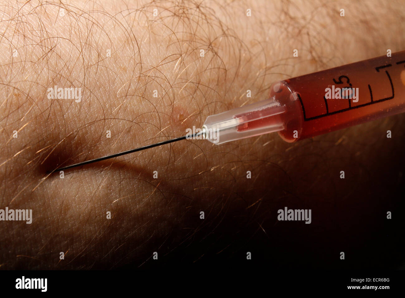 Injektion in den arm Stockfoto
