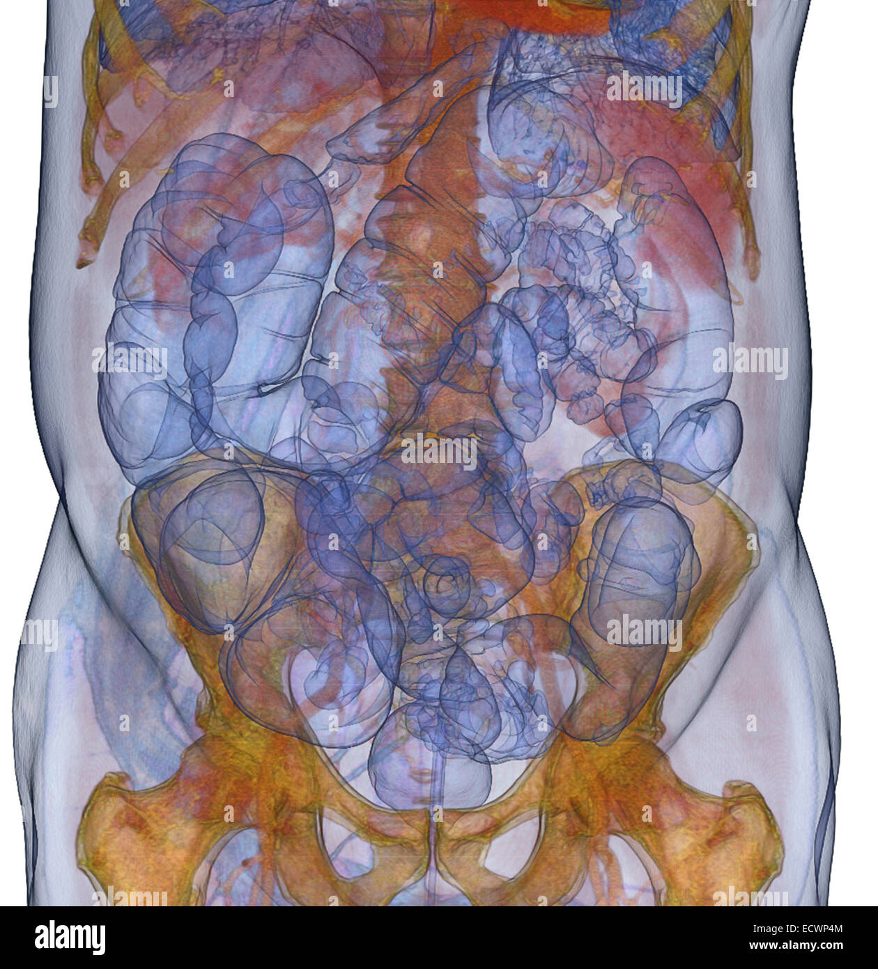 3D CT-Scan Bild eines CT-Koloskopie-Verfahrens. Stockfoto