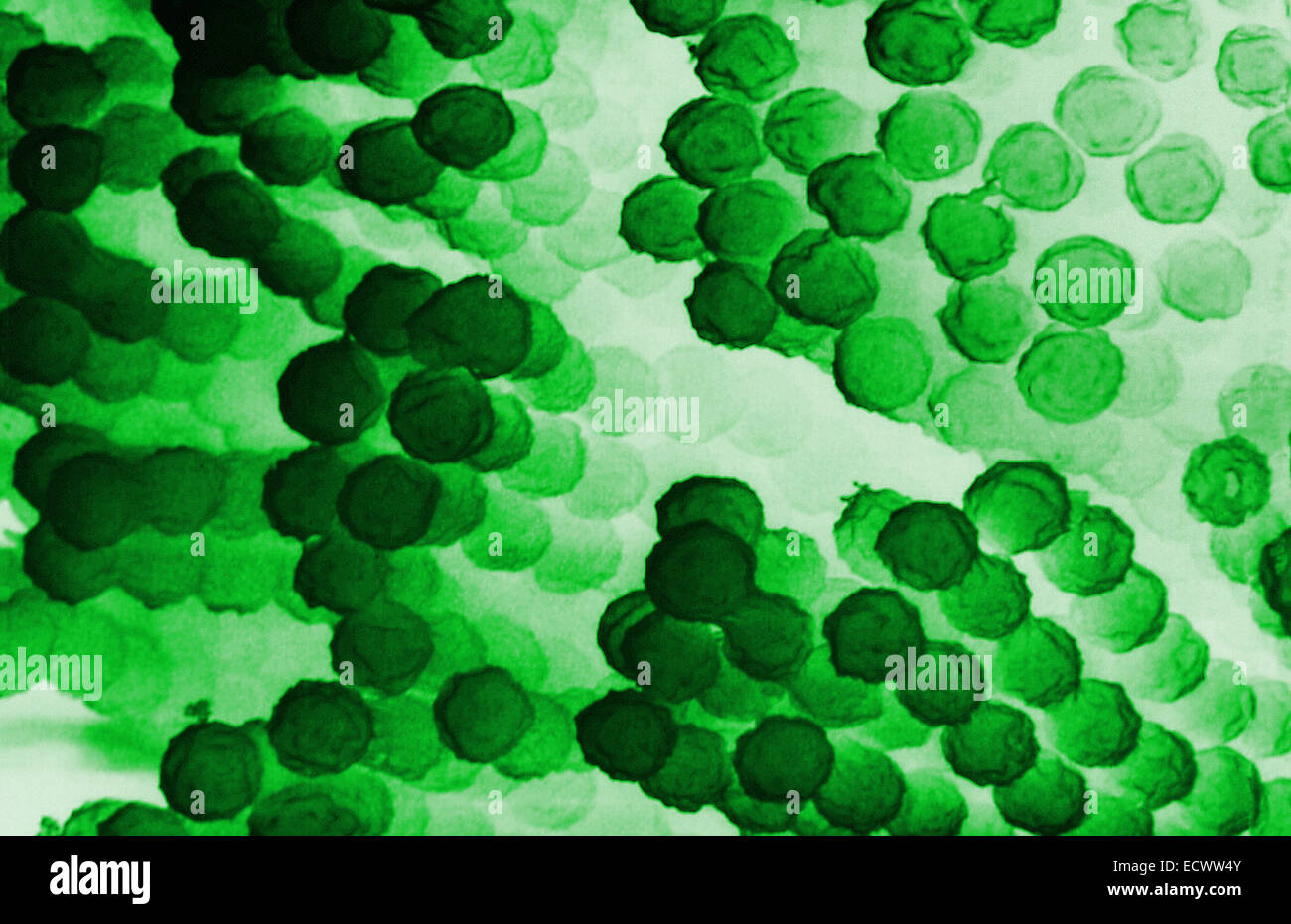 Elektron Schliffbild von Aspergillus Pilze aus. Stockfoto