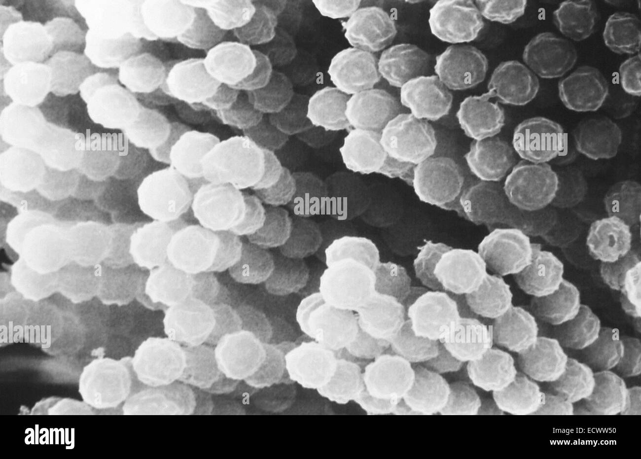 Elektron Schliffbild von Aspergillus Pilze aus. Stockfoto