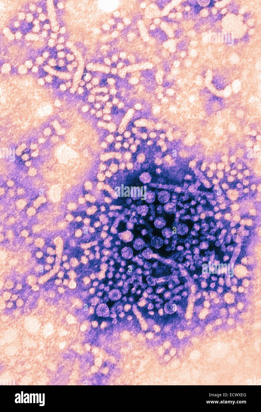 Transmission Electron Schliffbild des Hepatitis B-Virus. Stockfoto