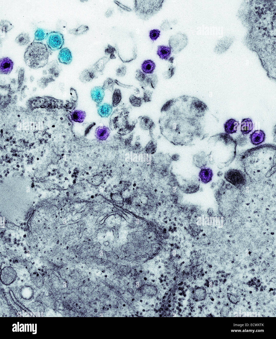 Menschliche T-Zell-Leukämie-Virus und HIV. Stockfoto