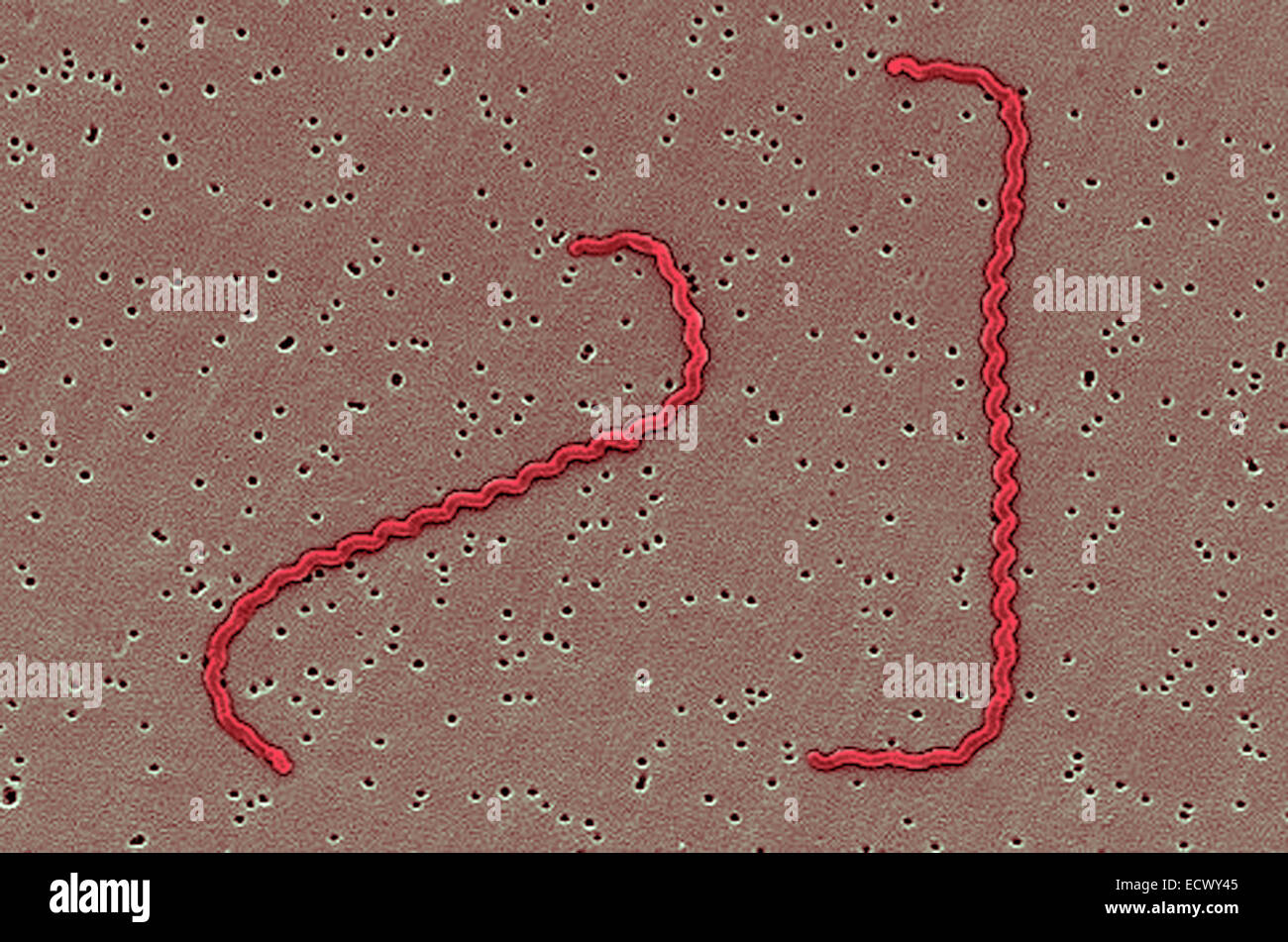 Scanning Electron Schliffbild von Leptospiren-Bakterien. Stockfoto