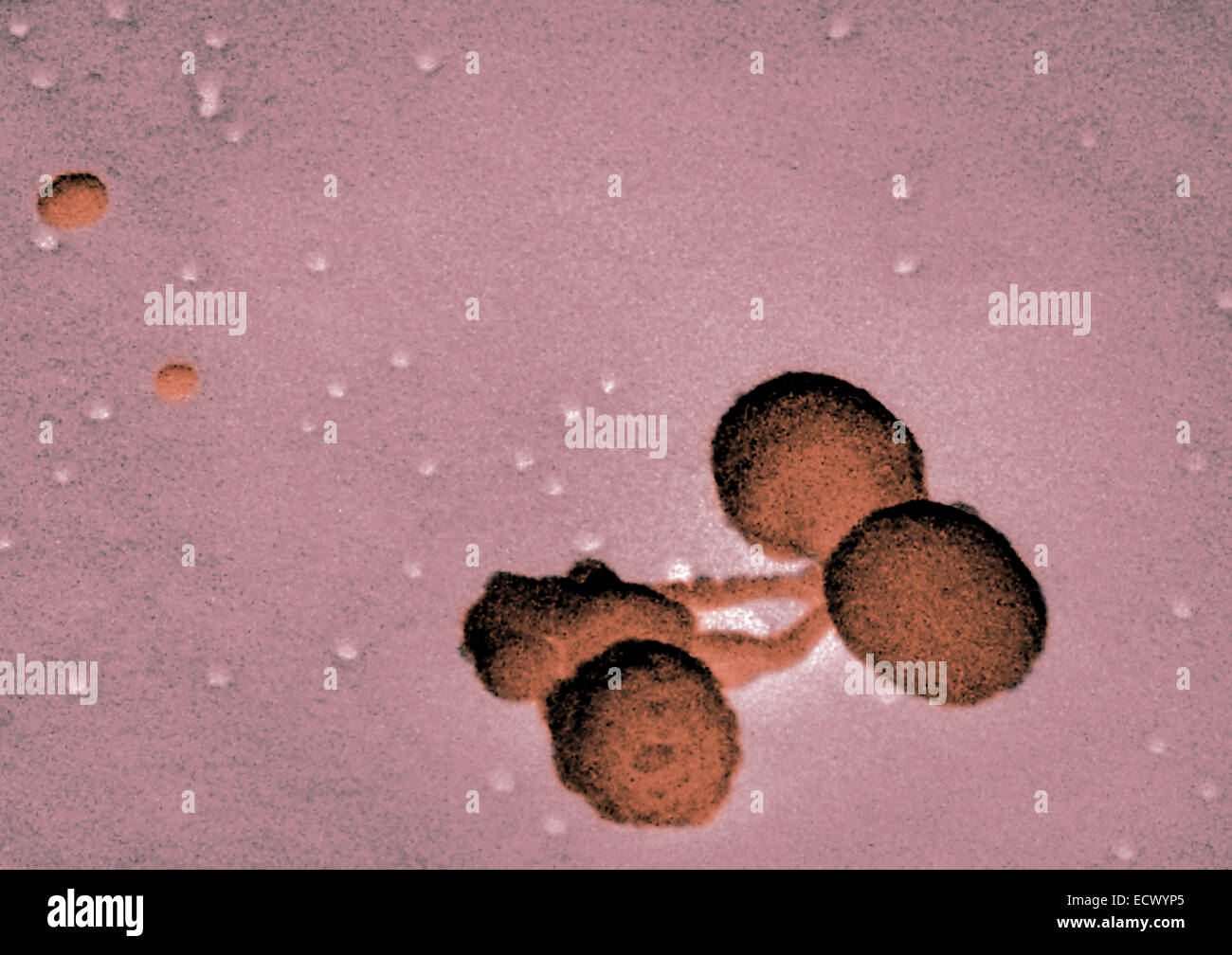 Scanning Electron Schliffbild Streptococcus Pneumoniae. Stockfoto