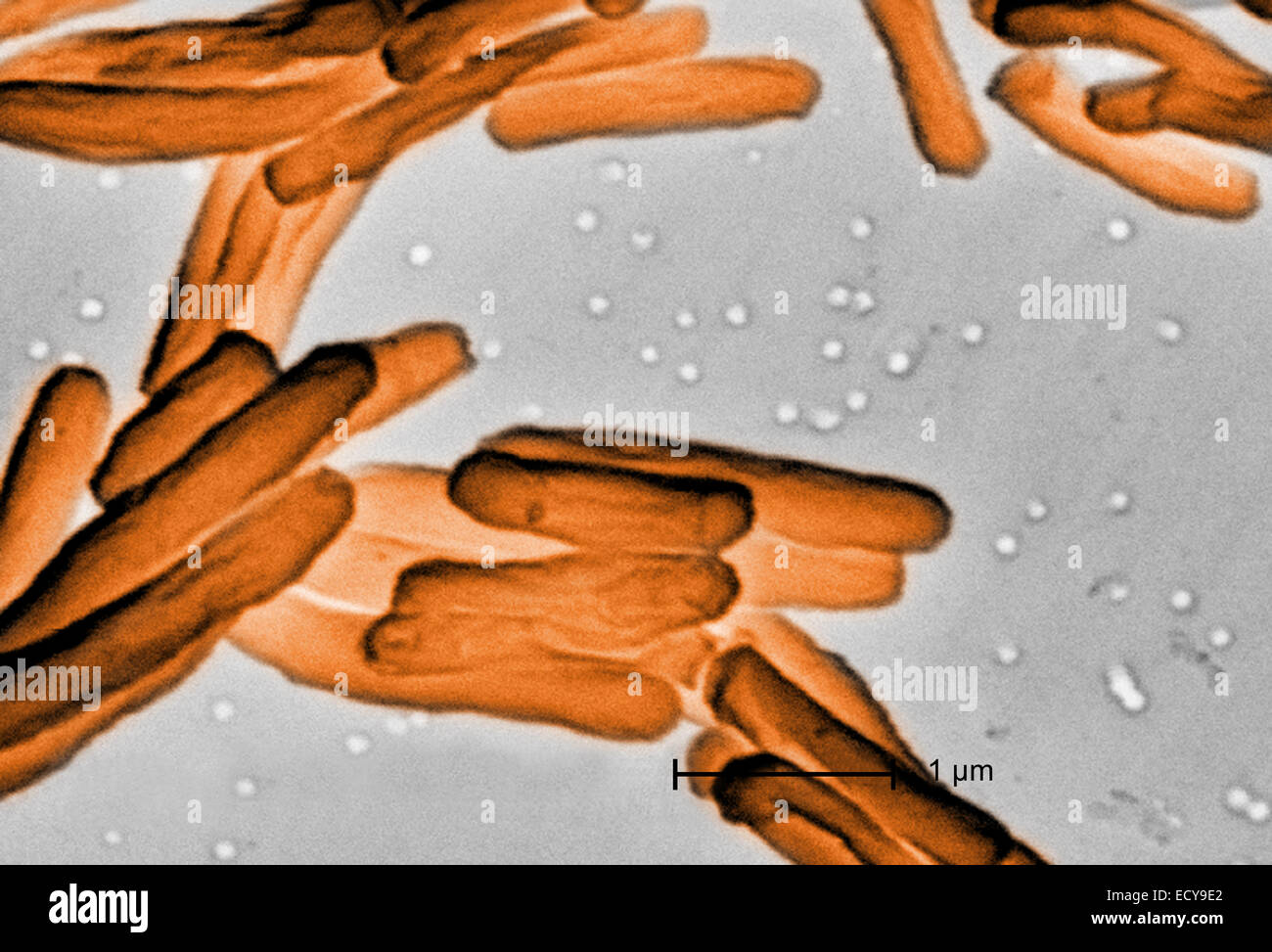 Scanning Electron Schliffbild der Tuberkulose-Bakterien. Stockfoto